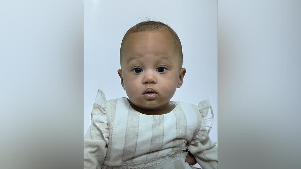 Ein gutes halbes Jahr ist die kleine Kymia nun alt. In London könnte das Mädchen kurzfristig die notwendige Behandlung erhalten. Doch dafür ist die junge Familie dringend auf Spenden angewiesen. Ein gutes halbes Jahr ist die kleine Kymia nun alt. In London könnte das Mädchen kurzfristig die notwendige Behandlung erhalten. Doch dafür ist die junge Familie dringend auf Spenden angewiesen.