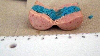 In Landshut sind am Wochenende mehrere Giftköder aufgetaucht. Die Wurststücke wurden offenbar mit Rattengift versehen. (Foto: Polizei) In Landshut sind am Wochenende mehrere Giftköder aufgetaucht. Die Wurststücke wurden offenbar mit Rattengift versehen. (Foto: Polizei)